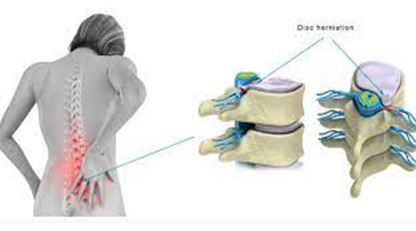 ढाडको नशा च्याप्पिने समस्या के हो ? कसरी गर्ने उपचार ?